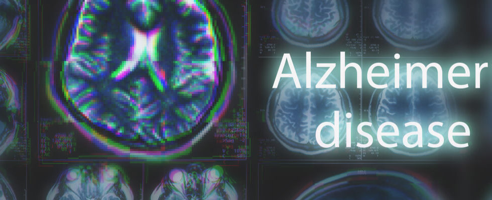 Pain in a Senior With Late-Stage Alzheimers