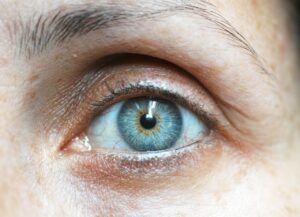 What Do Dementia Eyes Look Like?